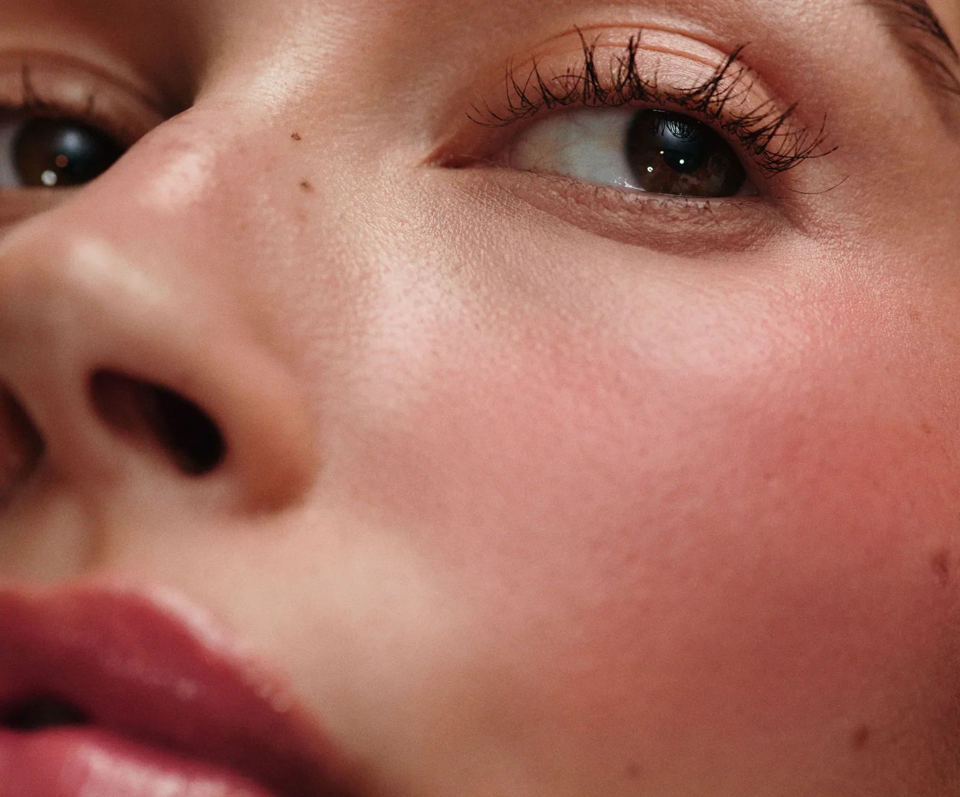 #variant_freckle