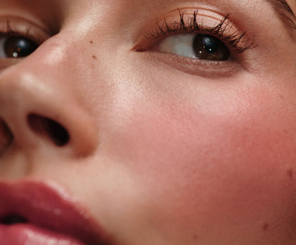 #variant_freckle