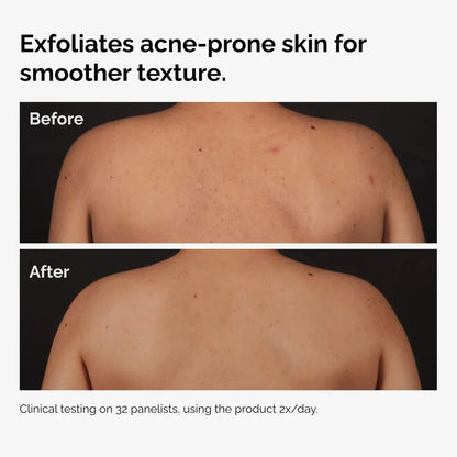 The Ordinary Body Care Collection